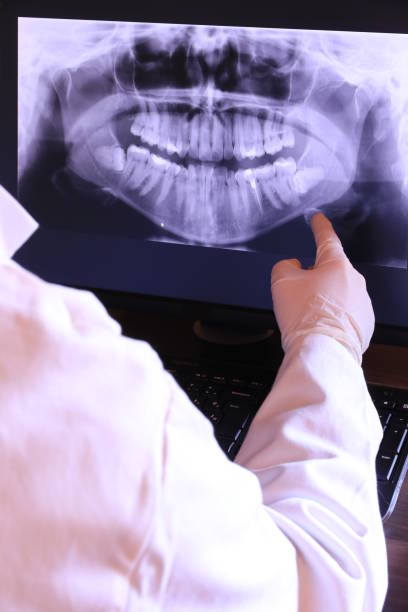 Best Emergency Dentist for Lost Fillings or Crowns in Murillo, TX